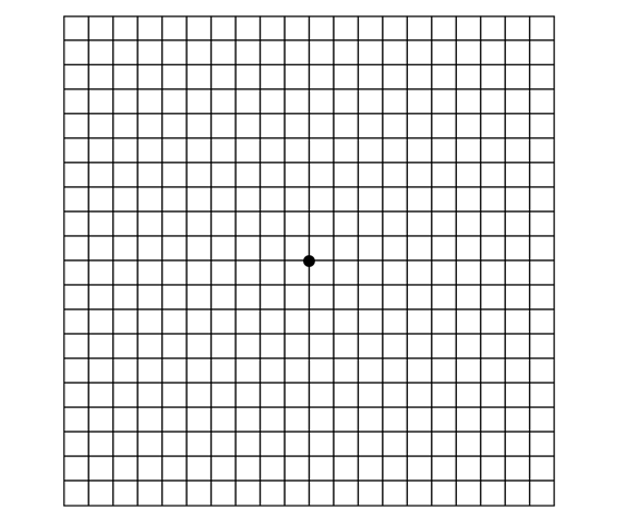 加齢黄斑変性だと歪む？見え方チェック