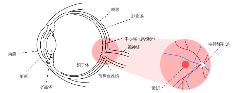 加齢で網膜に膜ができる？黄斑上膜